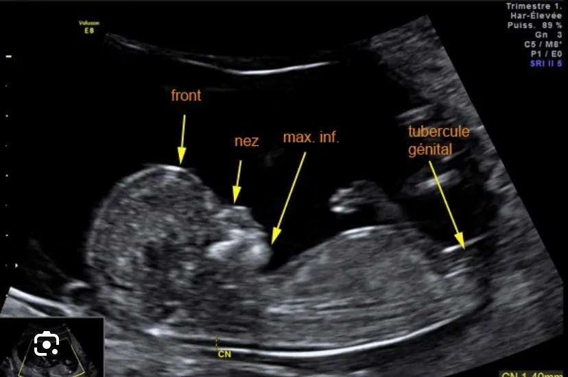 echographie 1 PURE clinique medicale